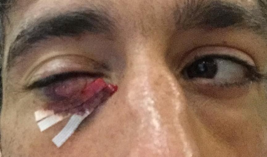 Legez kanpoko kolpea jaso ostean, bertan behera utzi zuten Aratz Garmendiaren borroka