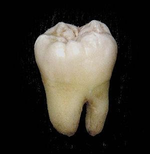 Dentibus ekimenak ahoaren doako azterketa egiteko aukera ekarriko du Laudiora