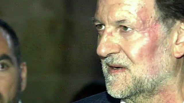 Rajoy kolpe bat jaso egin zuen 